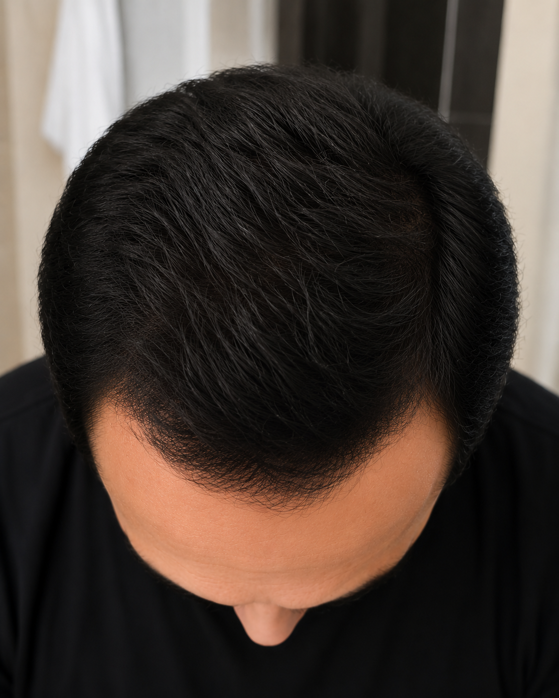 Before